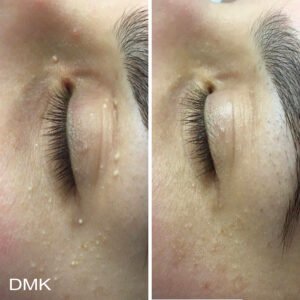 1906753110MyDMKBrandedBeforeandAfterImageryReactiveSkin6300dpi