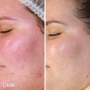 36160326MyDMKBrandedBeforeandAfterImageryReactiveSkin2300dpi